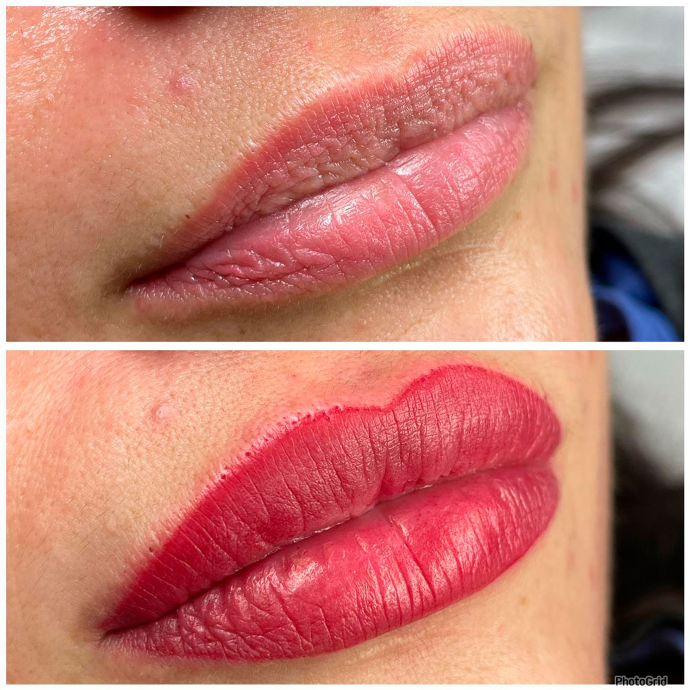 Micropigmentación de labios