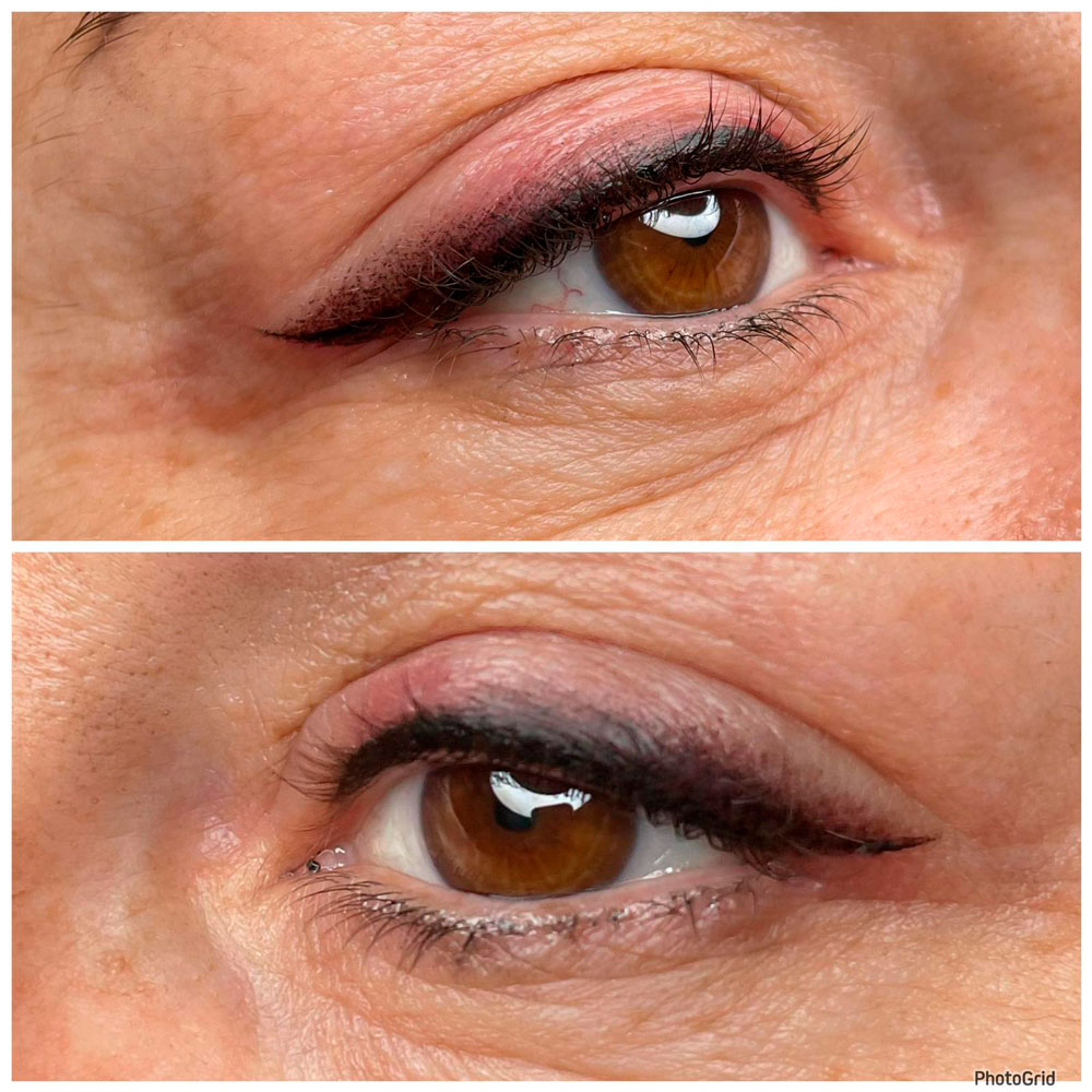 Micropigmentación de ojos